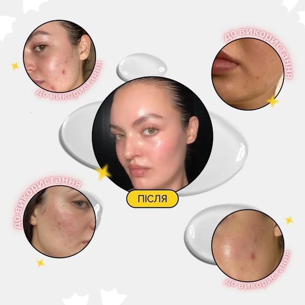 Medicube AGE-R Booster Pro Масажер Мікрострумовий для Обличчя Пристрій для Домашнього Догляду за Шкірою 6 в 1 Booster Pro фото