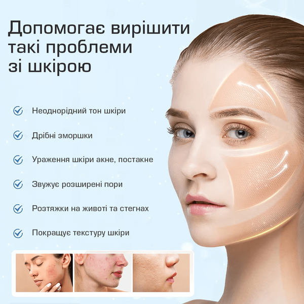 Дермапен Hydra Pen H5 з електропорацією та подачею сироватки дермаштамп + EMS-мікроструми  H5 фото