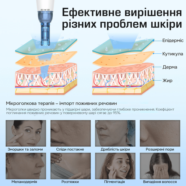 Дермапен Dr. Pen А9 від мережі дермаштамп для фракційної мезотерапії електричний мезоролер  A9 фото
